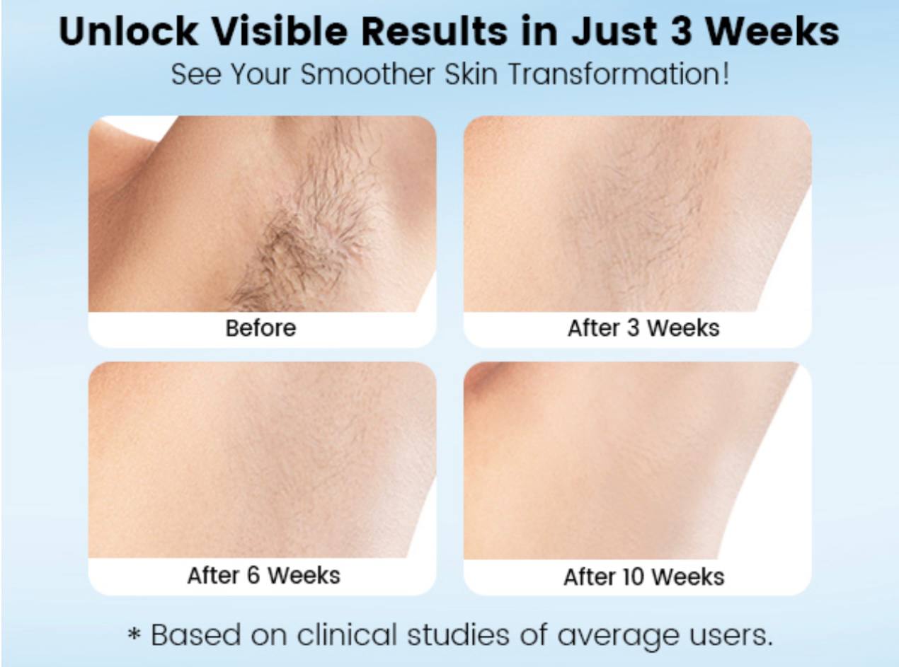 IPL Laser Hair Removal Device for Women Men at Home