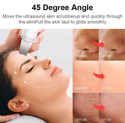Glow & Go Face Skin Blackhead Remover Spatula